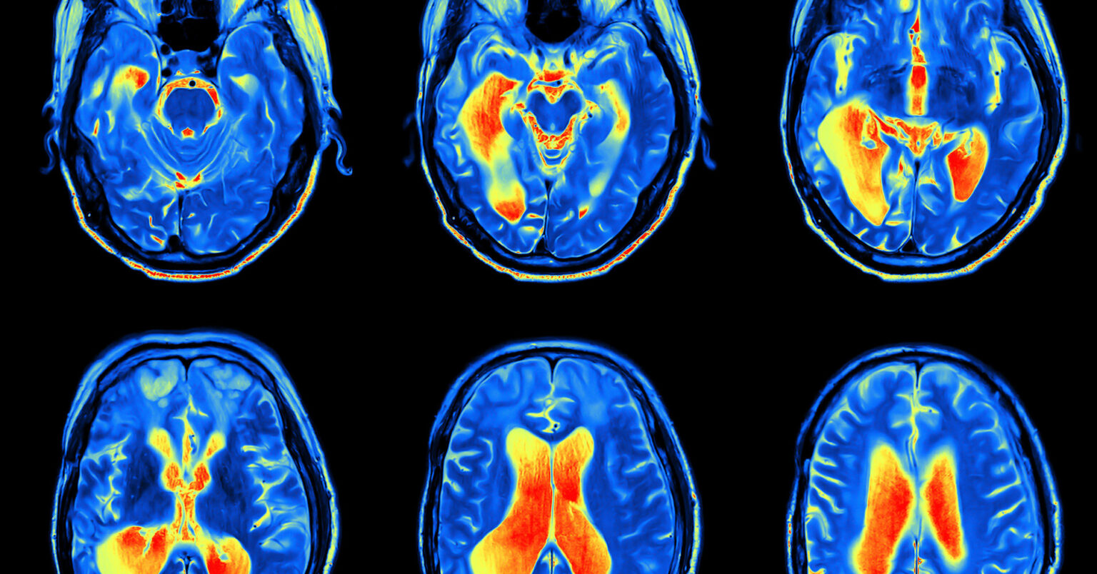Mri Scan Image Of Brain Regional Medical Imaging
