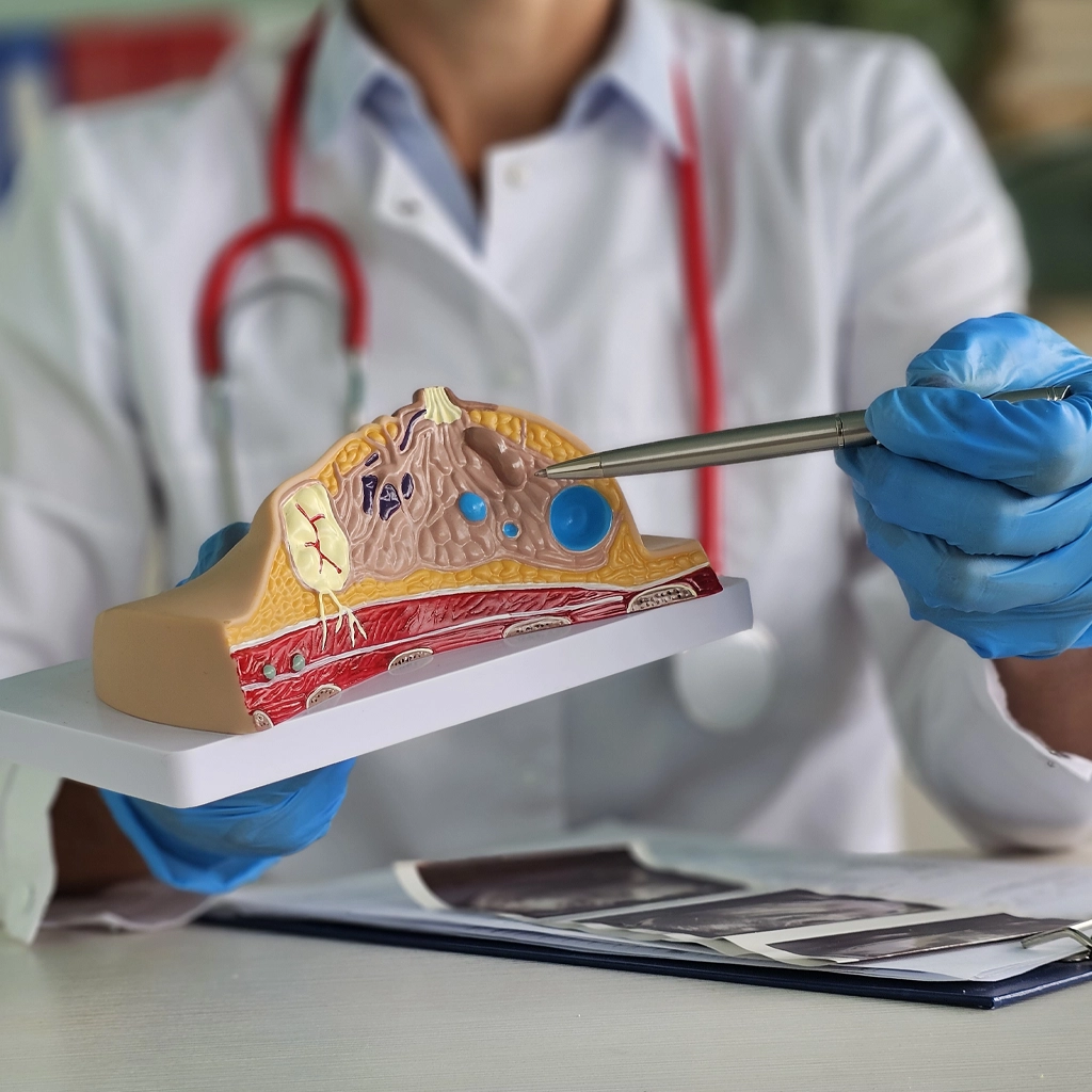 Image-Guided Breast Biopsy