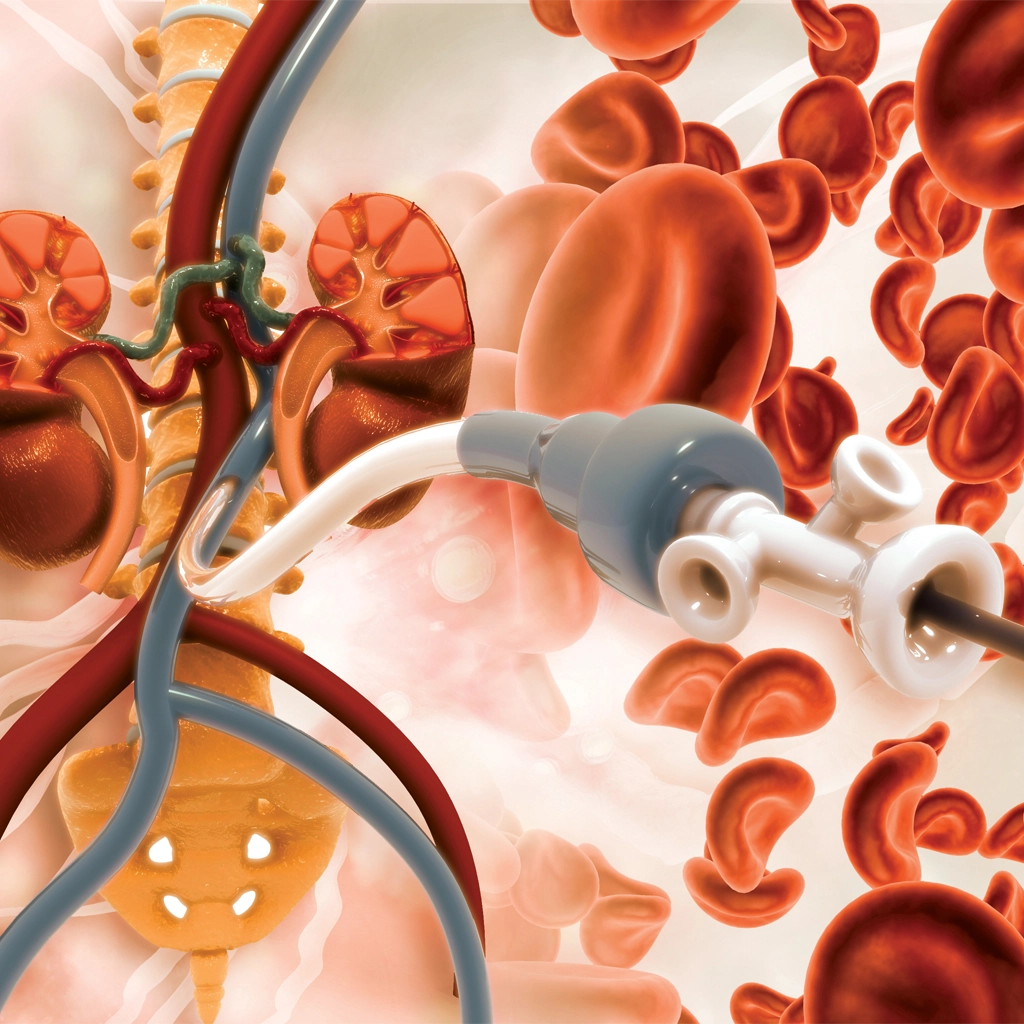 vascular access michigan