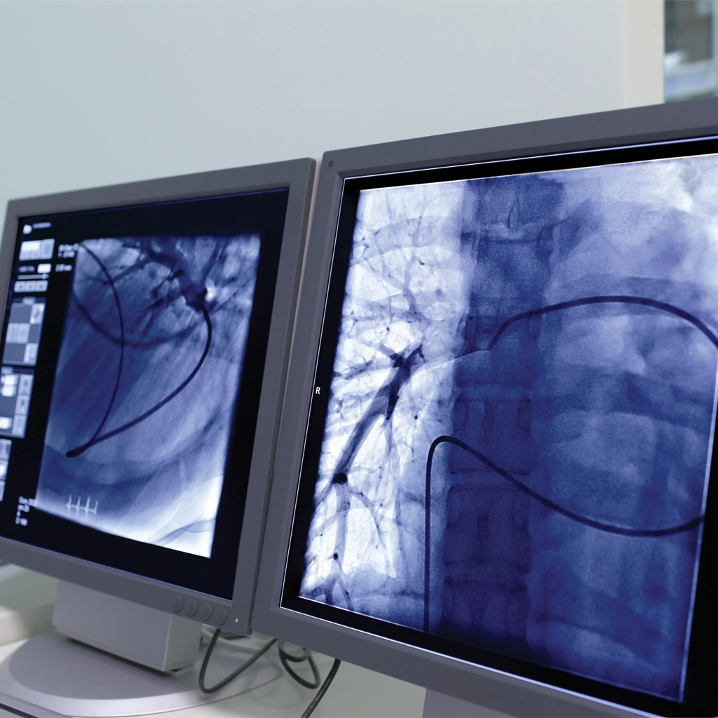 interventional radiology