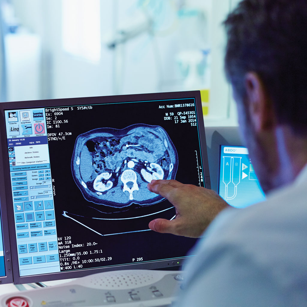 Whole-Body MRI Doctor Read