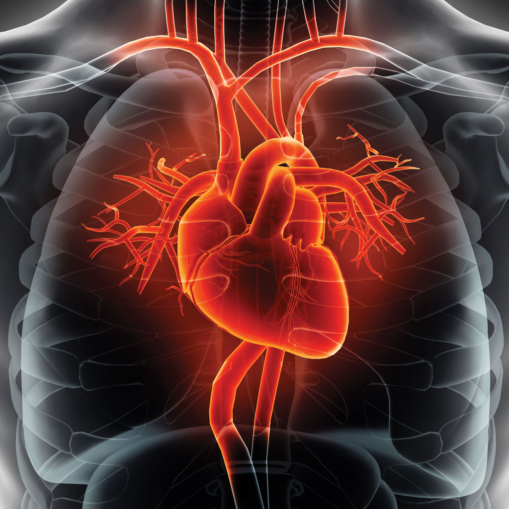 Heart Calcium Score Test Heart Illustration