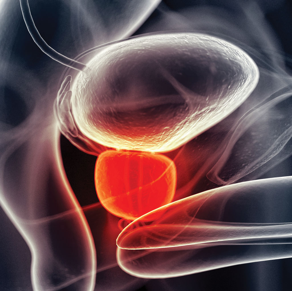Prostate MRI Scan Render